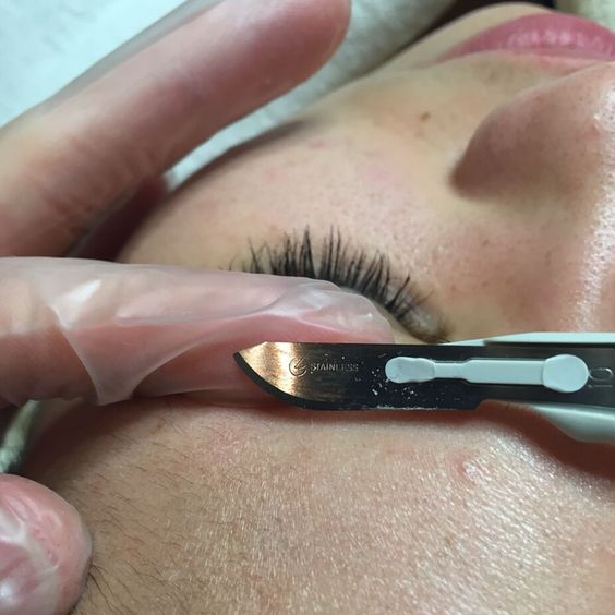 Dermaplane Facial