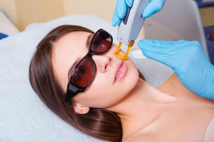 Laser Hair Removal (FACE)